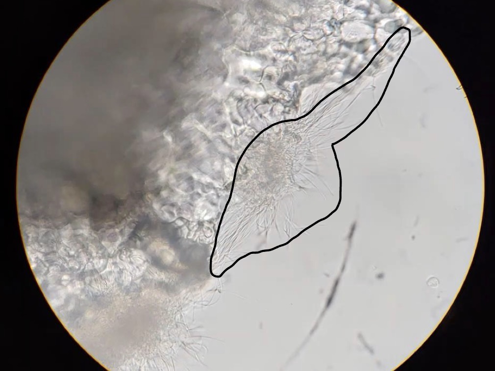 <p>What bacteria is shown on the wet mount slide?</p>