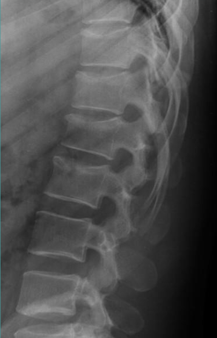<p>Is this fracture stable/unstable and new/old?</p>
