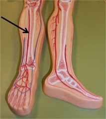 <p>ANTERIOR TIBIAL</p>
