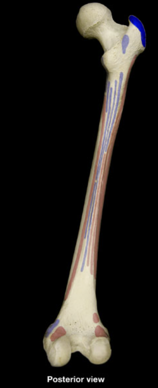 <p>greater trochanter of femur</p>