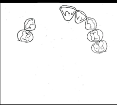 <p>What is the kennedy/applegate classification?</p>