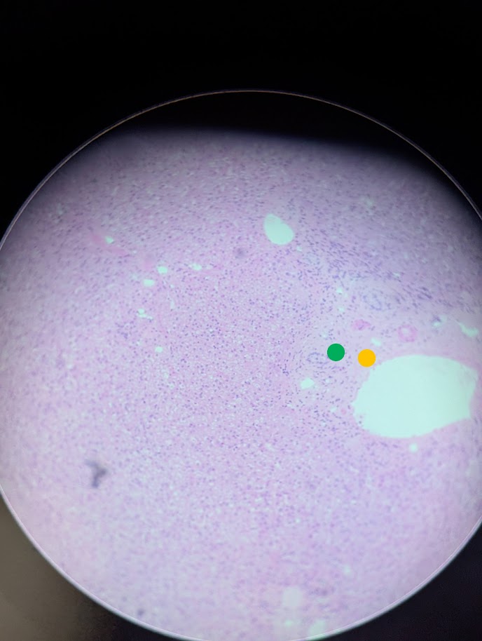 <p>Where in the body is this</p>