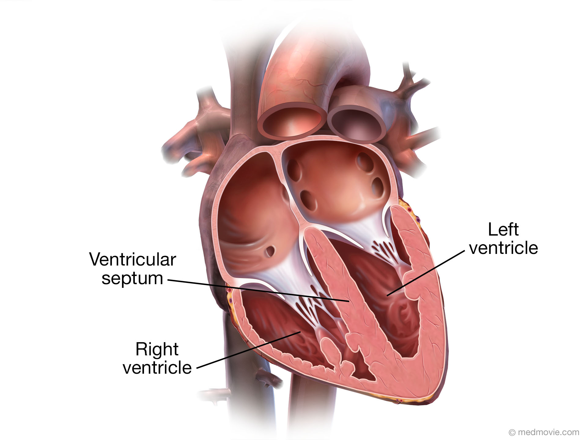 <ul><li><p>pumps that eject blood into the arteries and keep it flowing through the body</p></li><li><p>Right ventricle is most of the anterior of the heart </p></li><li><p>Left ventricle forms the apex and inferoposterior aspect </p></li><li><p>Ventricles are seperated by the interventricular septum </p></li><li><p>Right ventricle pumps blood only to the lungs and back to the left atrium, only moderately muscular </p></li><li><p>Left ventricle is 2 - 4 x as thick because it is the greatest workload, pumping blood through the entire body, roughly circular in cross sections </p></li><li><p>Right ventricle wraps around the left and is C shaped </p></li><li><p>both ventricles have internal ridges called trabeculae carneae, this is what keeps the ventricular walls from being like suction cups to one another, and allows them to refill </p></li></ul><p></p>