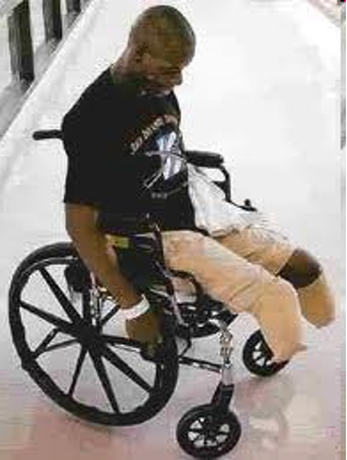 <ul><li><p>hip flexion </p></li><li><p>knee flexion </p></li></ul><p></p>