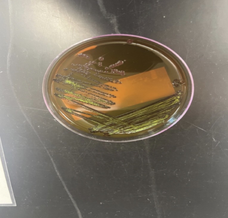 <p>Escherichia coli</p>