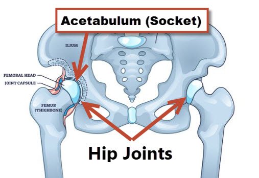 <p>Reamed to accept the acetabular cup.</p>