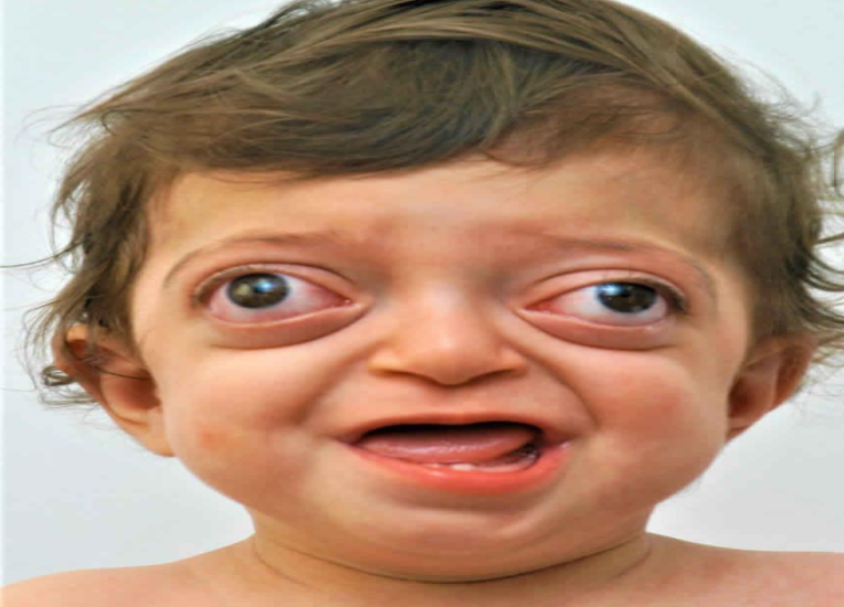 term image