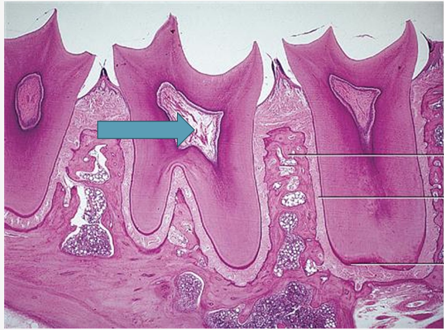 <p>Identify the region of the tooth</p>