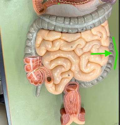 <p>What is the arrow pointing at?</p>