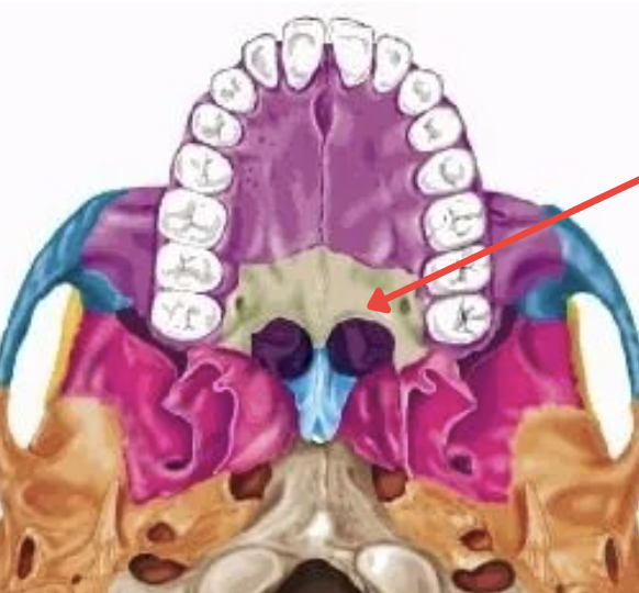 term image