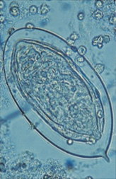 <p>What is this parasite (genus and species)?</p><p>What is its morphological form?</p>