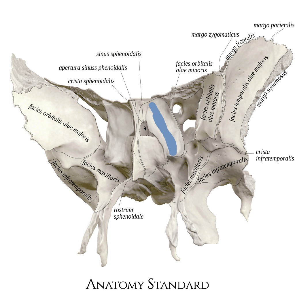 term image