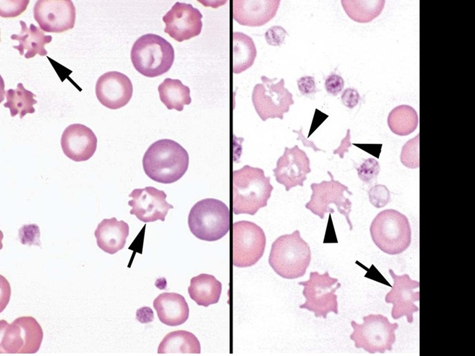 <p><span>The complete arrows ON THE LEFT image are pointing to…?</span></p>
