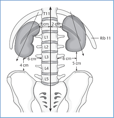 <p>T11-L3</p>
