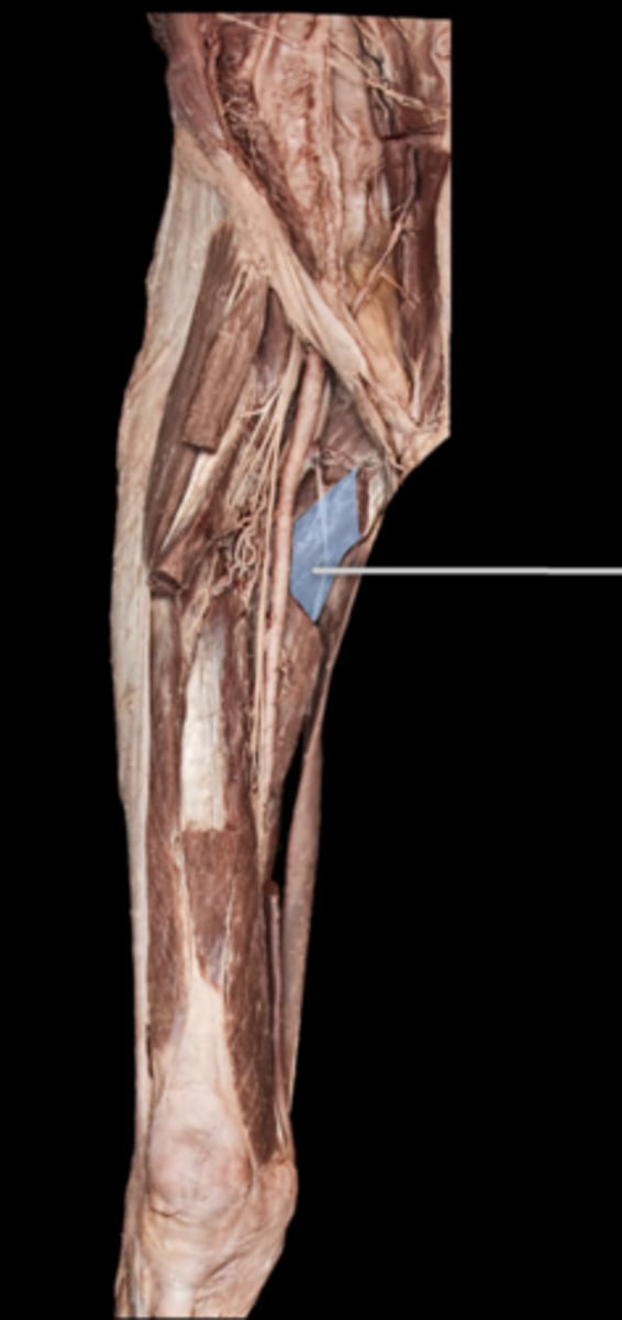 <p>What muscle is this?</p>