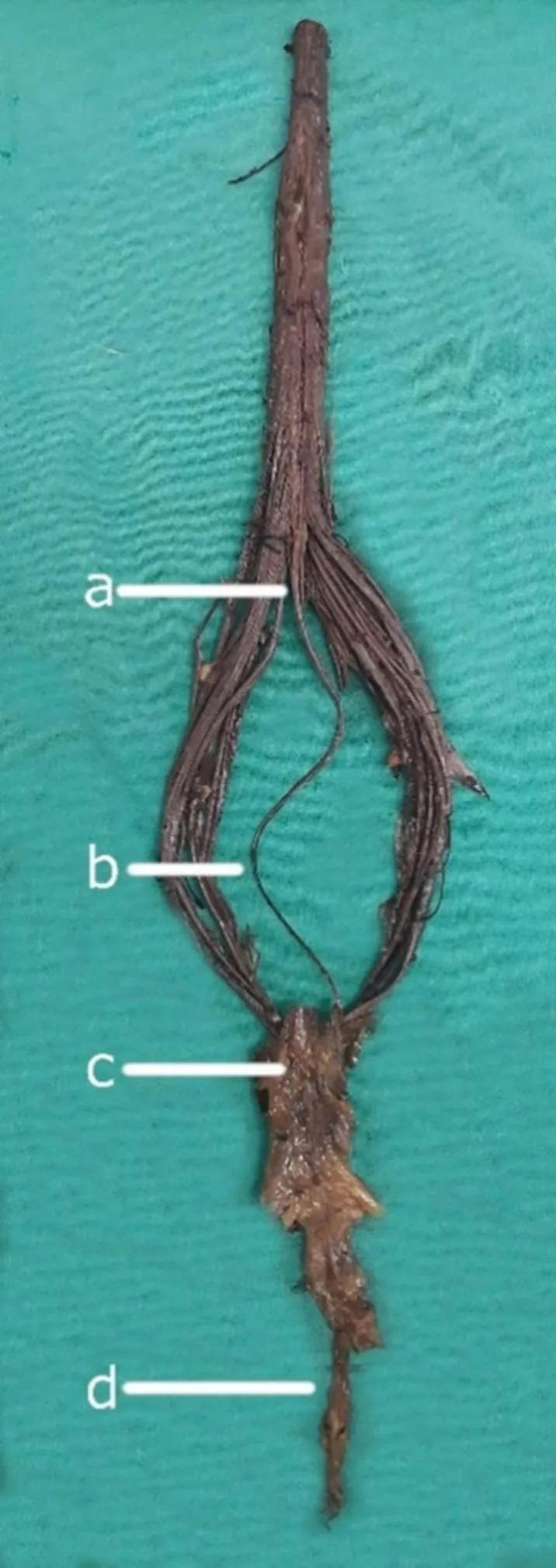 <p>B/D</p>