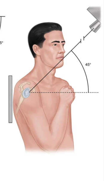 <p>45° caudal </p>