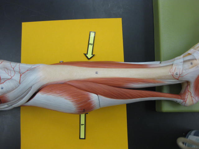 <p>What is at #1?</p>