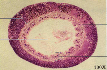 <p>is this male or female stage</p>