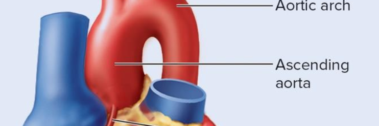 <p>ascending aorta</p>