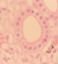 <p>Where can you find the <span>Simple Cuboidal Epithelial </span></p>