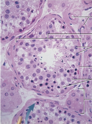 <p>What cell is shown </p>