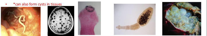 <p>- Haemaphrodite - worm has male + female reproductive organs</p><p>- Body composed of segments or proglottids, no body cavity</p><p>- Adults attach to gut by scolex, have a closed intestine</p><p>- Live for decades</p><p>- Intestinal worms asymptomatic, tissue stages cause pathology</p><p>.</p><p>INTESTINAL TAPEWORMS</p><p>- Taenia solium (pork TW)*</p><p>- Taenia saginata (beef TW)</p><p>- Diphyllobothrium latum (fish TW)• Hymenolepis nana (dwarf TW)</p><p>- Hymenolepis diminuta (Rat TW)</p><p>- Exists as worms in intestine</p><p>- *can also form cysts in tissues</p><p>.</p><p>TISSUE TAPEWORMS:</p><p>- Echinococcus granulosis (Dog TW)</p><p>- Echinococcus multilocularis</p><p>- Spargenosis (Spirometra spp)</p><p>- Form cysts in the tissues</p><p>.</p><p>- example of tissue tapeworms is the ones in raw pork</p>