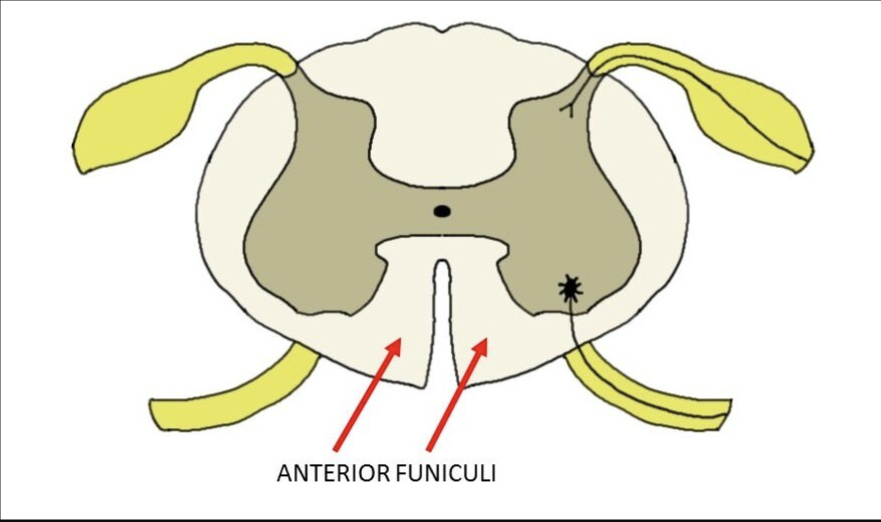<p>ANTERIOR FUNICULUS’ function SENSORY, MIXED or MOTOR?</p>