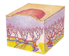 <ul><li><p>Transient- short term</p></li><li><p>elevated lesion caused by local edema</p></li><li><p>irregular shaped, variable diameter</p></li><li><p>solid</p></li></ul><p></p>