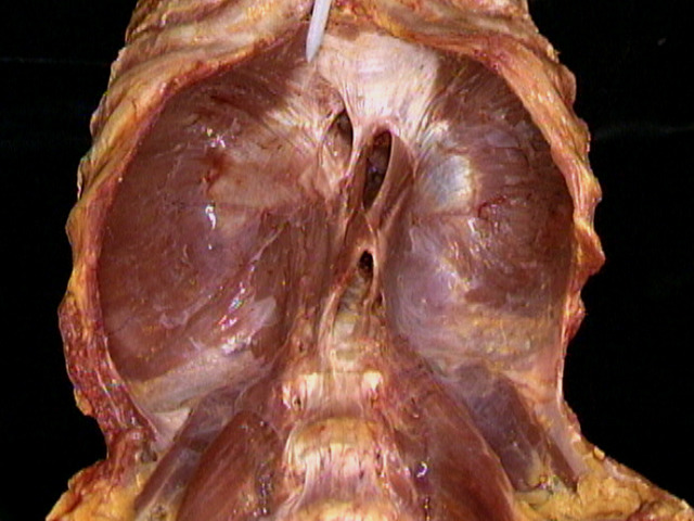 <p>Innervation of this muscle </p>