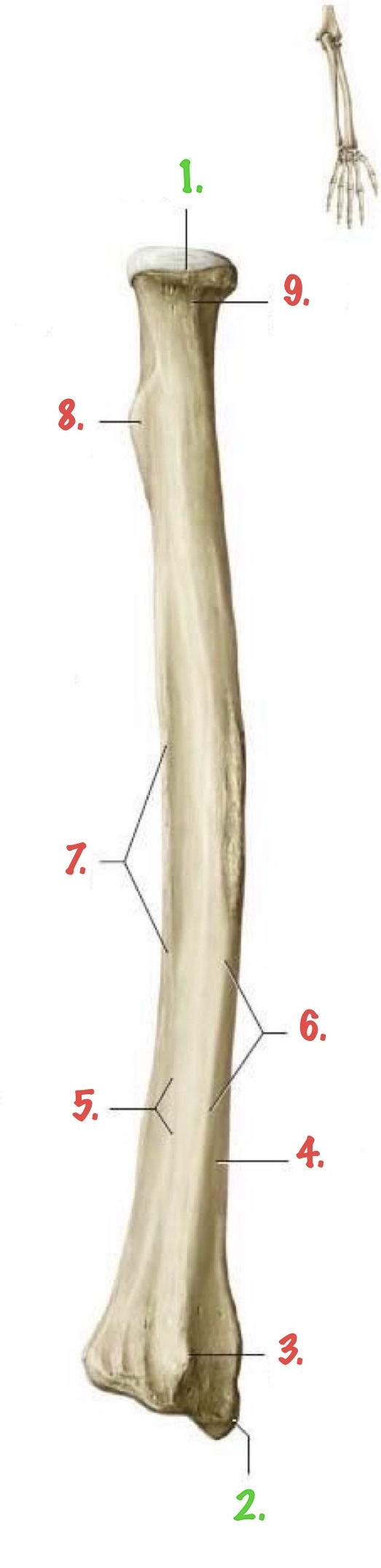 <p>Identify 1.</p>
