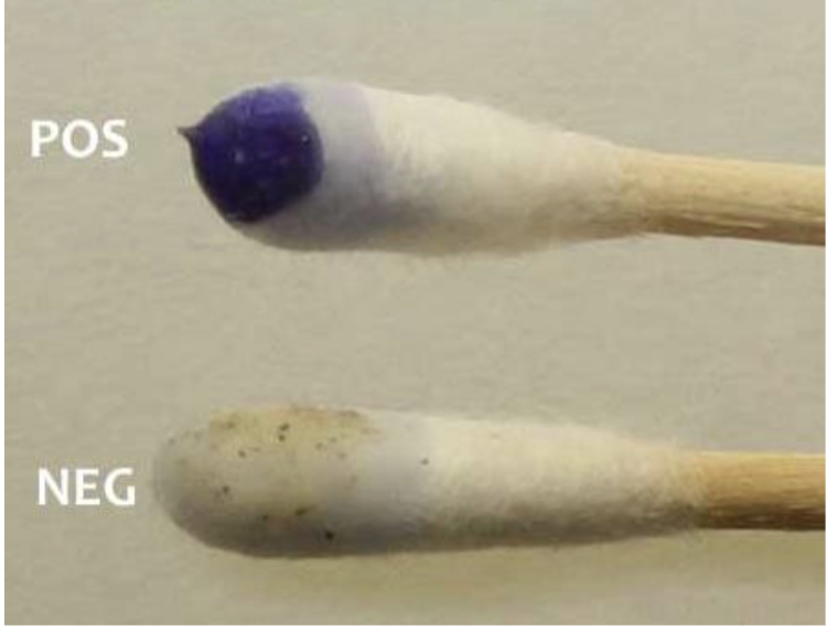 <p>if it’s blue/black what <strong>bacteria</strong> is it?</p>