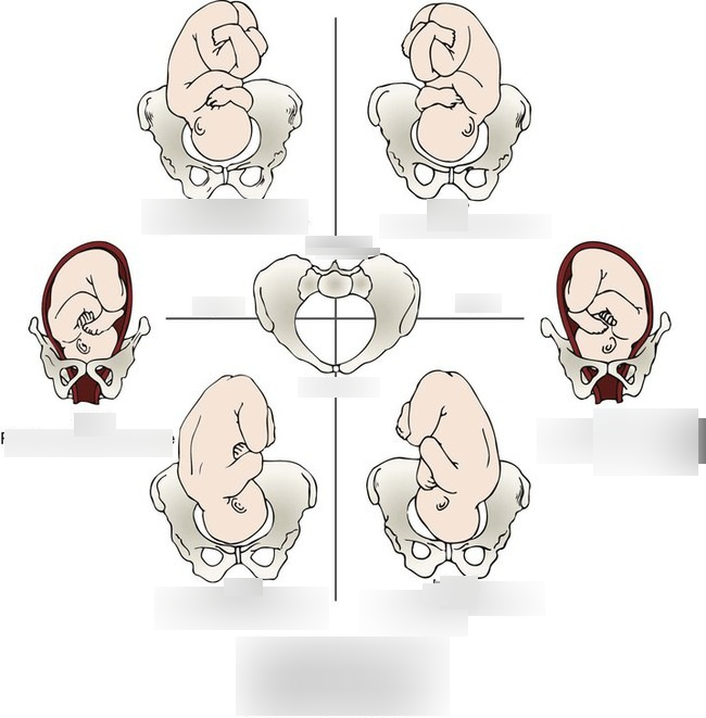 <p>Determine the fetal positions: </p>