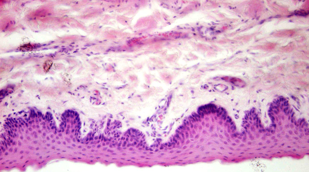 <p>soort epitheel</p>