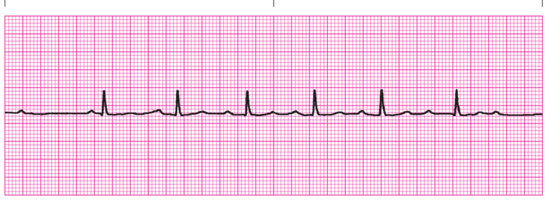 <p>QRS?</p>