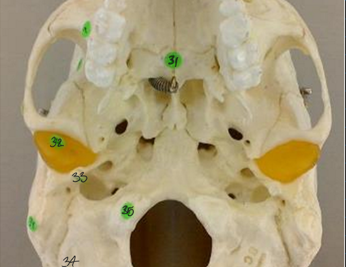 <p>31</p>