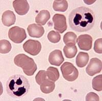 <p>Blood</p>