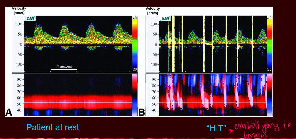 <p>an <strong>audible chirp</strong> and <strong>simultaneous visual HIT on screen </strong></p>