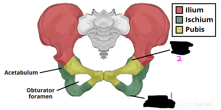 <p>label this diagram of the ischial features on the pelvis</p>