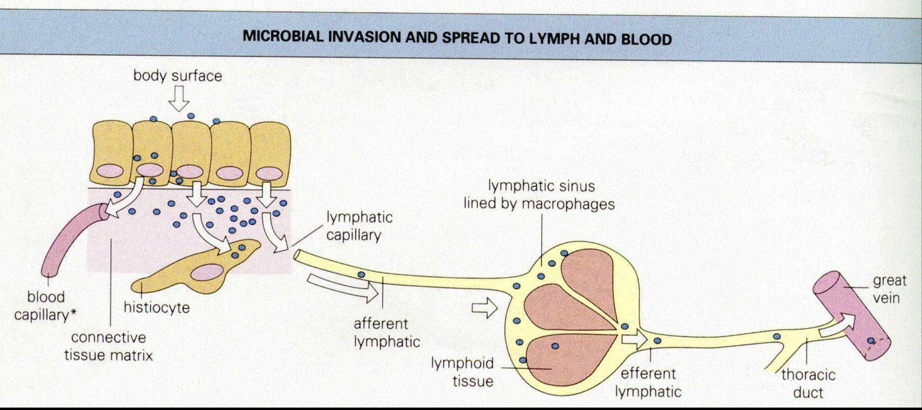 <p><strong>1. Lymphatic spread →</strong> system is designed to filter out particular material such as bacteria but is less efficient when:</p><p><mark data-color="red" style="background-color: red; color: inherit;">• there is high lymph flow due to acute tissue inflammation</mark></p><p><mark data-color="red" style="background-color: red; color: inherit;">• there is a high concentration of organisms</mark></p><p><mark data-color="red" style="background-color: red; color: inherit;">• allows for spread of phagocytosis-resistant organisms </mark></p><p><strong>2.Vascular system spread → </strong> most convenient route</p><p>– <u>must be resistant or be able to evade the complex </u>vascular system<u> immune defence</u>s</p><p>• some organisms can transmit freely within the plasma <em><mark data-color="red" style="background-color: red; color: inherit;">(Bacillus anthracis and Leptospira species)</mark></em></p><p>• other organisms can survive and transported in mononuclear cells (Mycobacterium and Listeria monocytogenes)</p>