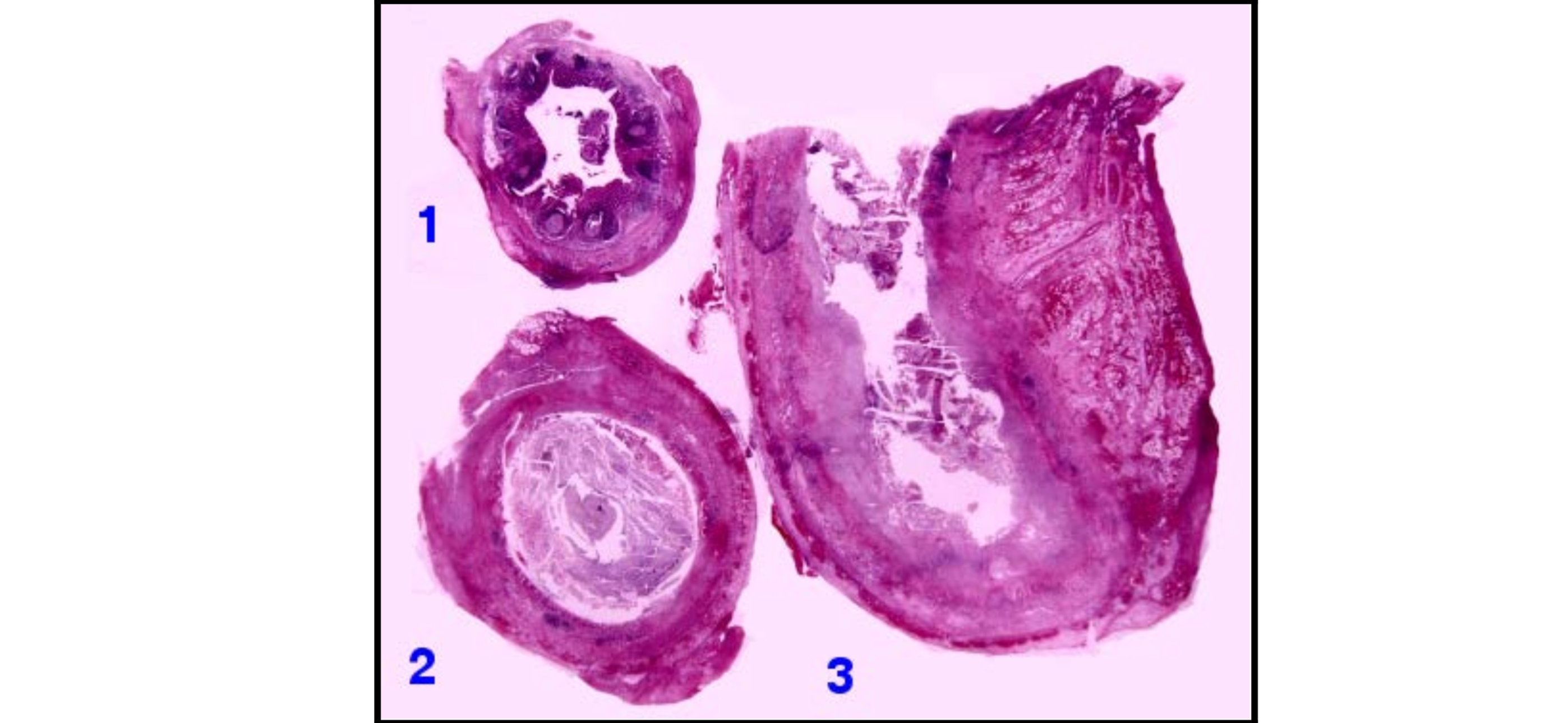 <p>Bệnh lý gì</p>