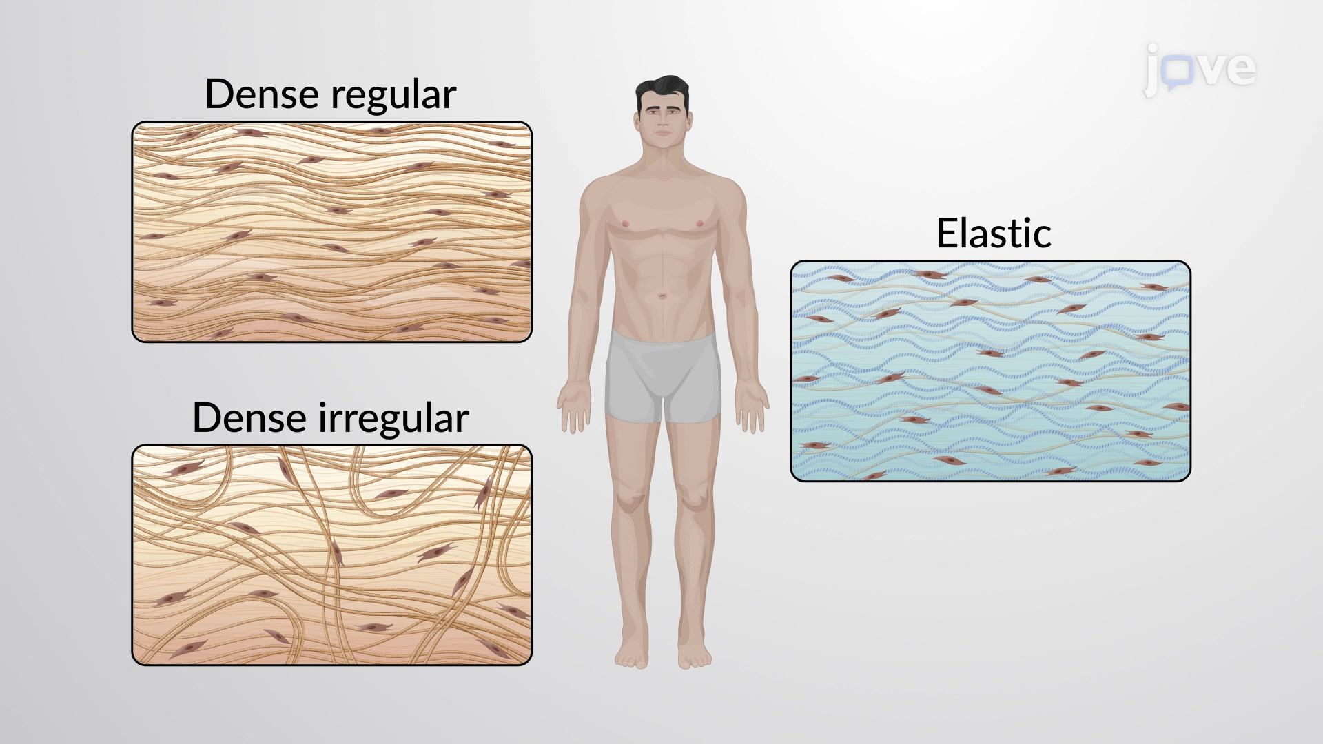 <p>Dense regular, dense irregular, and elastic connective tissue.</p>