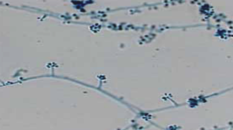 <p>“rosette” or “bouquet of flowers” </p>