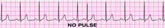 <p>Administer 1mg of epinephrine</p>