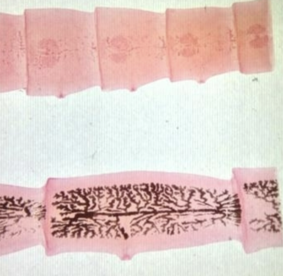 <p>What cestode/tapeworm/parasitic worm is this?</p>