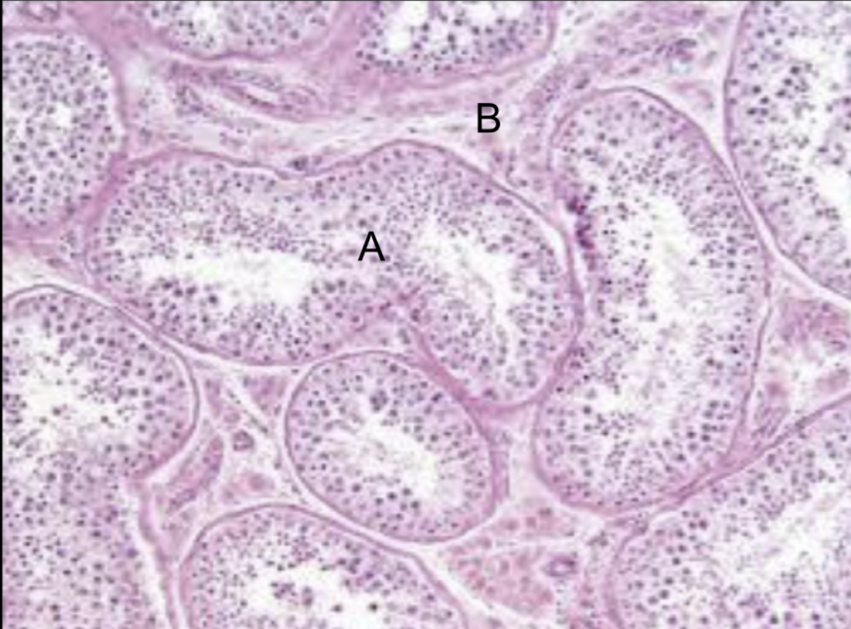 <p>What is structure B?</p>