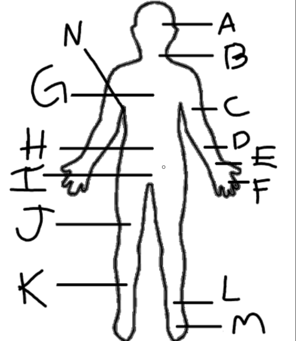 <p>Where is L pointing to</p>