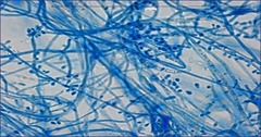 <p>Numerous Microconidia are common borne in grape-like cluster or singly along hyphae "birds on a fence". Causes dermatophytosis including athlete's foot and tinea barbae.</p>