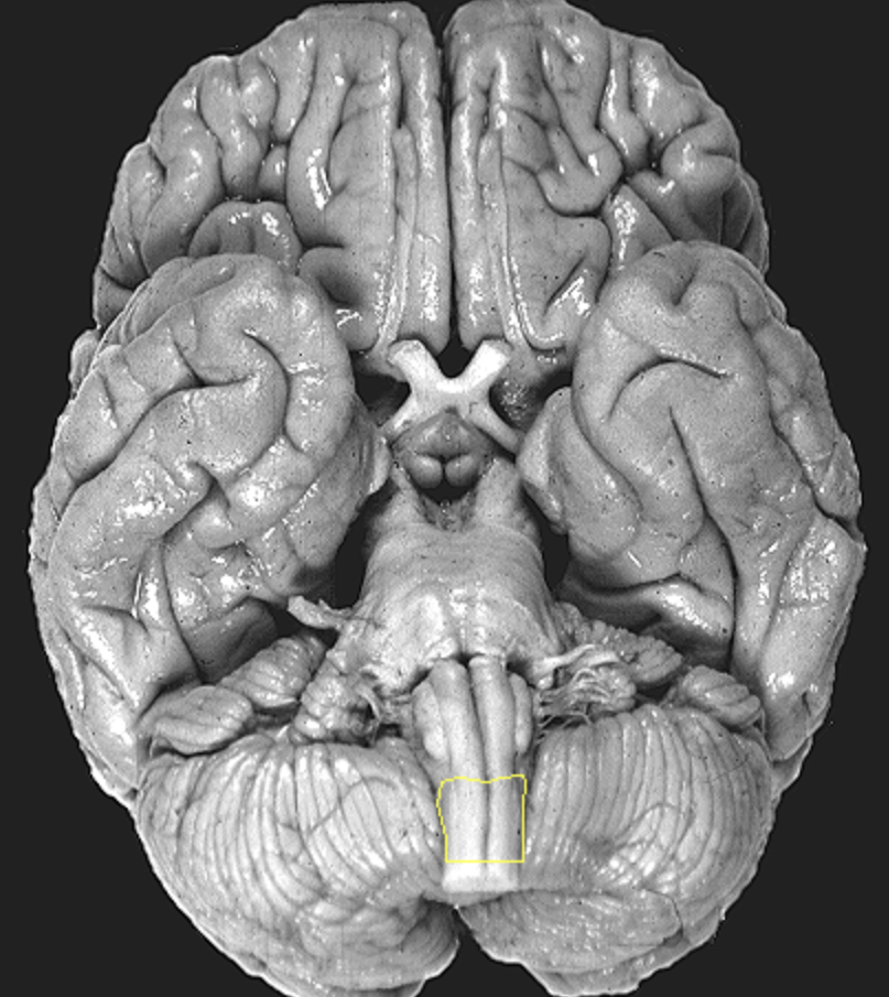 <p>What is the area highlighted called?</p>