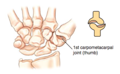 <p>A joint named for its saddle appearance, found at the first carpometacarpal joint.</p>